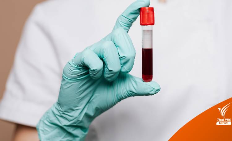 นักวิจัยสังเคราะห์ “เลือดเทียม” ทดลองทางคลินิกครั้งแรกของโลก